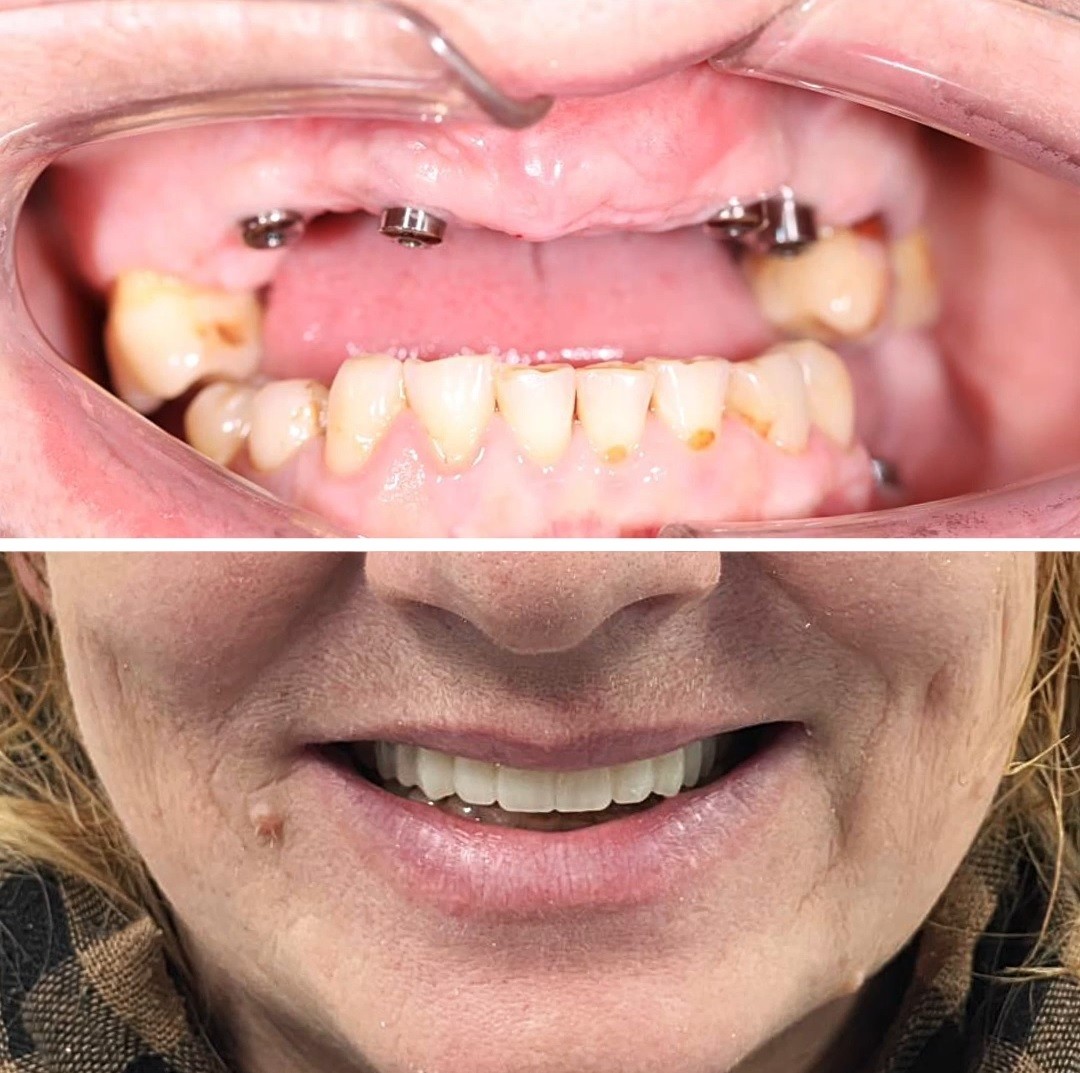 “ALL ON 4” или «Всё на четырёх» | ЦРС Краснодар